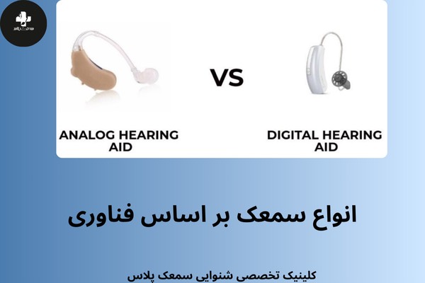 انواع سمعک بر اساس سطح فناوری