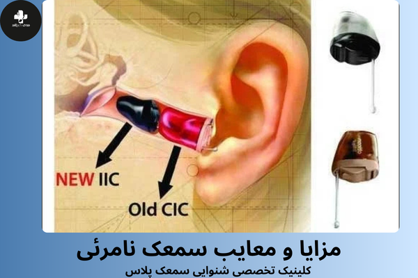 مزایای سمعک نامرئی